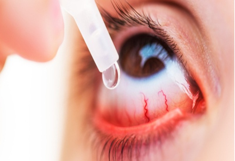 Dùng thuốc điều trị đau mắt theo hướng dẫn của bác sĩ