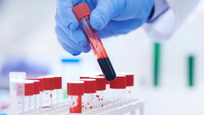 Một số xét nghiệm máu được chỉ định để đánh giá tình trạng sốt xuất huyết