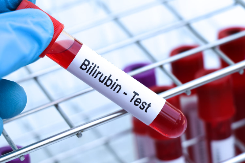 Bilirubin đến từ sự phá hủy huyết sắc tố trong các tế bào hồng cầu ở lá lách