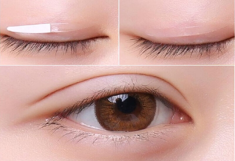 Trang điểm có thể giúp cải thiện tạm thời tình trạng mắt mí lót