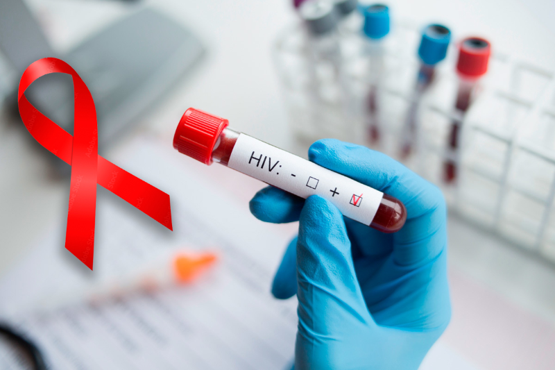 Xét nghiệm HIV là phương pháp kiểm tra để phát hiện sự hiện diện của virus HIV 