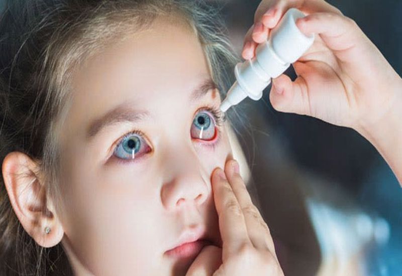 Dùng thuốc rửa mắt hoặc thuốc dưỡng mắt sẽ giúp phòng ngừa triệu chứng ngứa mắt trái