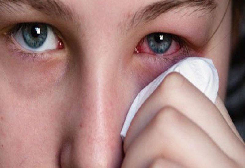 Nếu bạn bị ngứa mắt trái kèm các triệu chứng bất thường thì nên đi khám ngay
