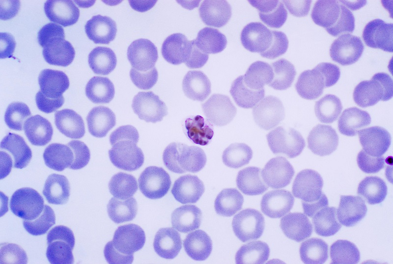 Plasmodium malariae virus