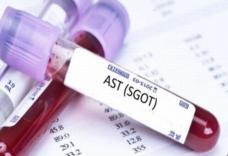 Xét nghiệm SGOT còn được gọi là xét nghiệm AST