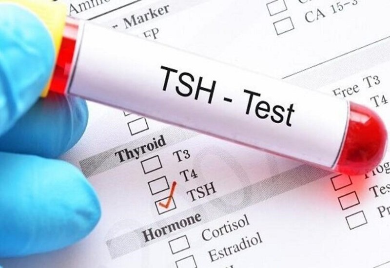 Người bệnh cường giáp dưới lâm sàng có chỉ số TSH giảm nhưng T3,T4 vẫn ở mức bình thường