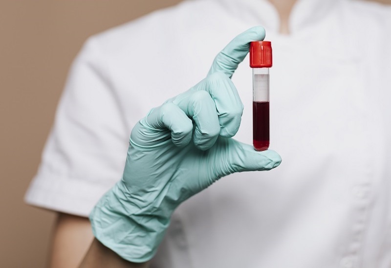 Chỉ số INR trong xét nghiệm máu giúp kiểm tra và đánh giá các bất thường về máu