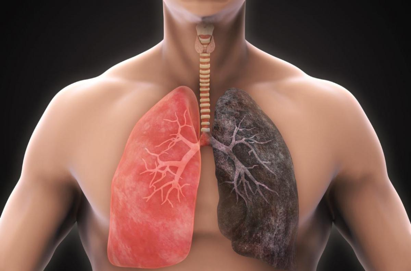 Tiếp xúc với các chất độc hại là một nguyên nhân liên quan đến ung thư phổi