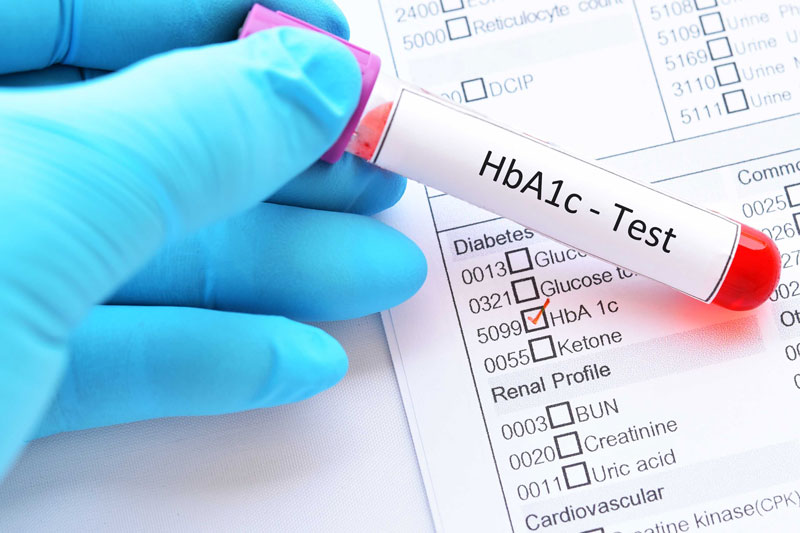 Xét nghiệm HbA1c giúp đánh giá lượng đường huyết và nguy cơ biến chứng mạch máu