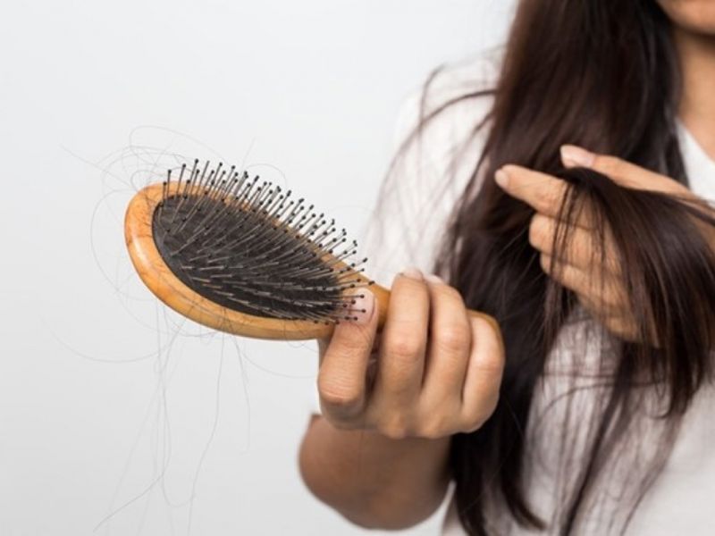 Cần có một số phương pháp ngăn ngừa rụng tóc tại nhà 