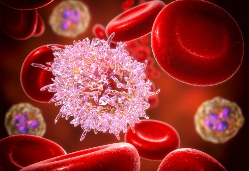Xét nghiệm máu toàn bộ có thể phát hiện bệnh bạch cầu