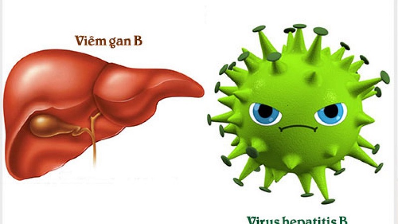 Viêm gan B là bệnh truyền nhiễm gây ra bởi virus viêm gan B (HBV)