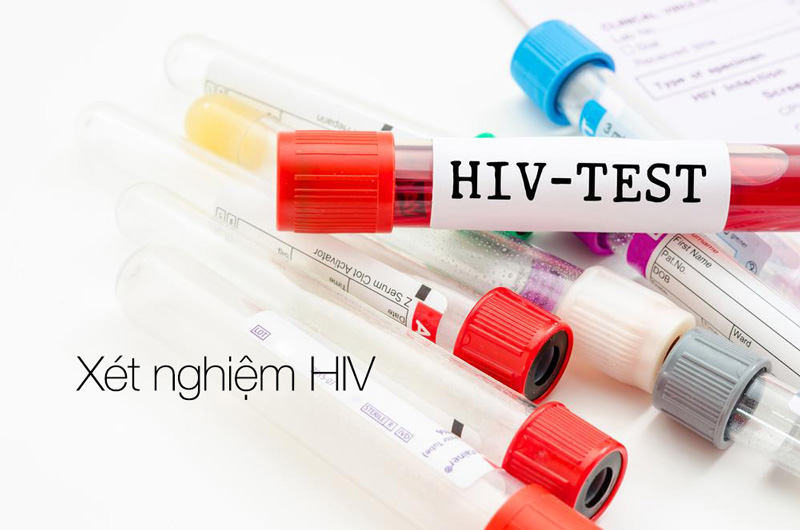 Những xét nghiệm phát hiện HIV
