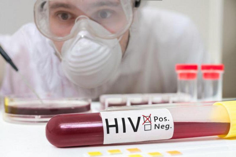 Quy trình xét nghiệm HIV rất chặt chẽ