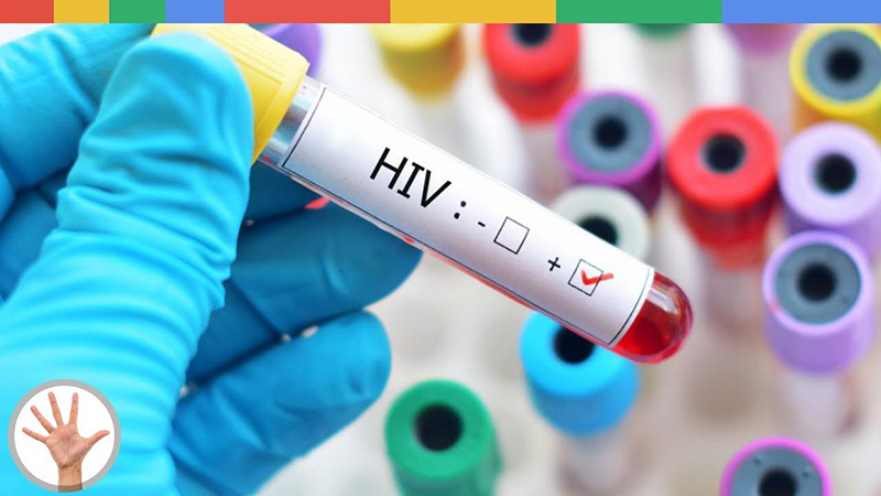 Có 2 loại xét nghiệm HIV là xét nghiệm tìm kháng thể kháng HIV và xét nghiệm tìm virus HIV