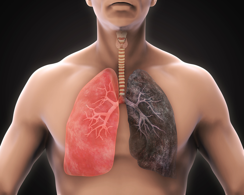 nên thực hiện tầm soát ung thư phổi định kỳ sau tuổi 40