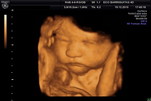 Siêu âm 4D- mẹ nhìn thấy được hình ảnh chân thực nhất của bé yêu ngay từ trong bụng mẹ