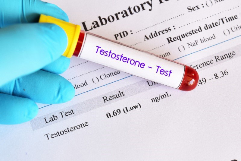 Sử dụng phương pháp xét nghiệm các chất nội tiết để chẩn đoán nguy cơ vô sinh ở nam giới