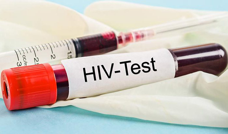Xét nghiệm HIV là kiểm tra kháng thể HIV có ở trong máu không