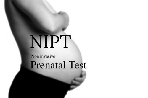xét nghiệm NIPT sàng lọc trước sinh