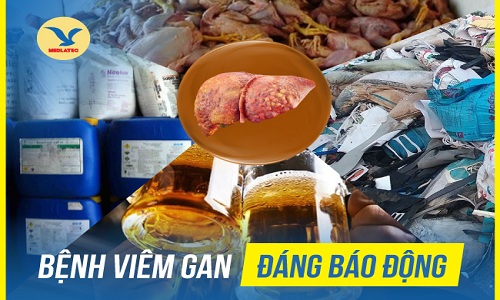 Chuyên gia Gan mật chia sẻ các bệnh lý về gan ở Việt Nam ngày một gia tăng