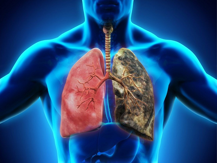 Ưu đãi khám phát hiện bệnh phổi tại MEDLATEC