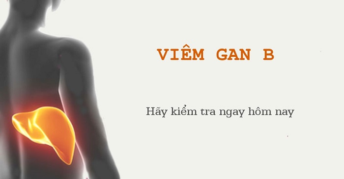 Việt Nam có khoảng 7,8 triệu người mắc viêm gan B mạn tính
