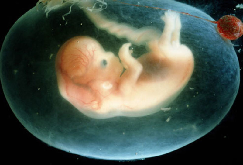 Bơm tinh trùng vào tử cung sinh con có tỷ lệ thành công bao nhiêu?