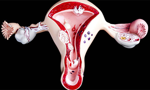 Buồng tử cung bất thường có thể gây nên tình trạng vô sinh hiếm muộn