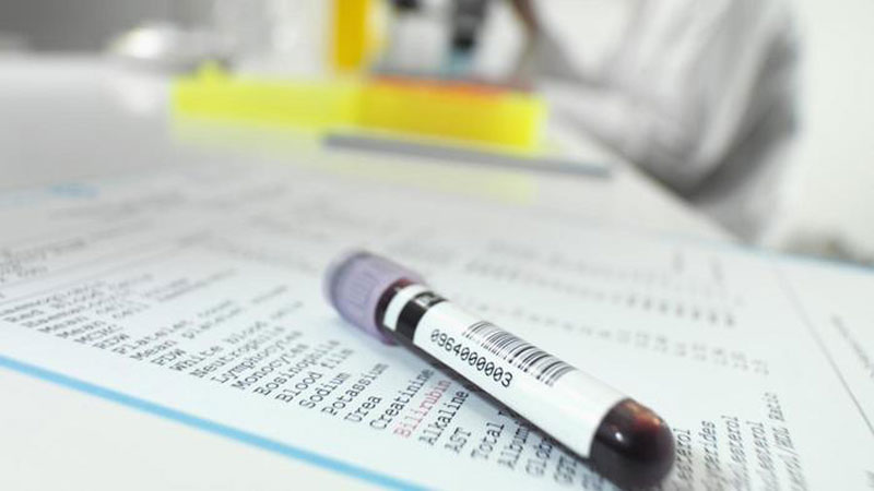 Các xét nghiệm viêm gan B thường gặp
