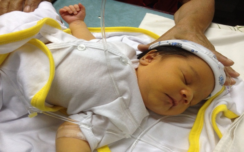 Trẻ bị vàng da là dấu hiệu của Bilirubin tăng trong máu
