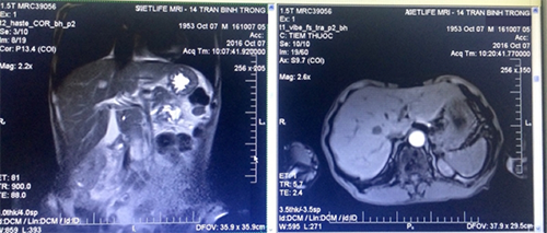 Hình ảnh thu được sau khi chụp MRI ổ bụng có độ nét cao, chi tiết