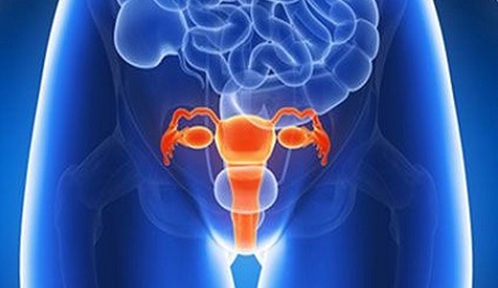 Chụp tử cung - vòi trứng được chỉ định làm để tìm nguyên nhân vô sinh ở nữ giới