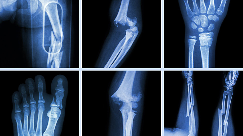 Thông qua phương pháp chụp X - quang, các bác sĩ có thể dễ dàng quan sát các bộ phận bên trong người bệnh mà không cần phải mổ