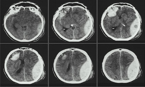 Chụp Ct sọ não tại Bệnh viện đa khoa MEDLATEC