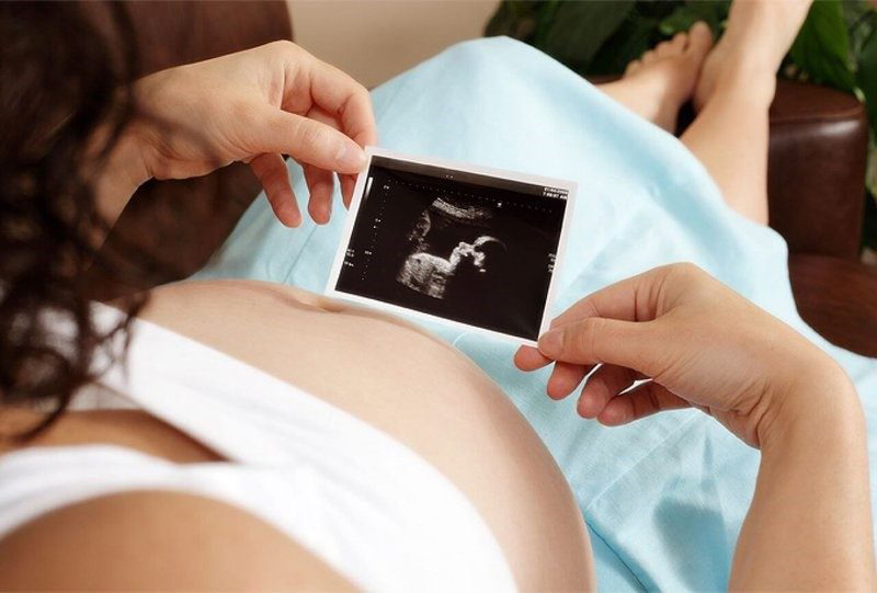 Siêu âm thai là phương pháp ghi lại hình ảnh thai nhi nằm trong bụng mẹ