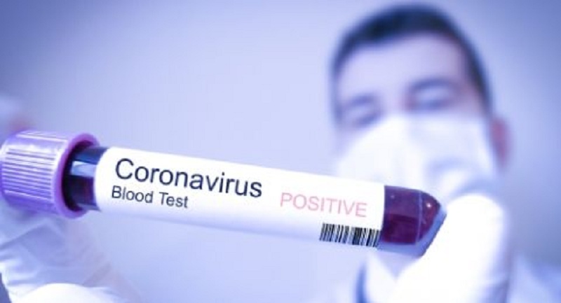 Mẫu bệnh phẩm dùng để test Coronavirus mới