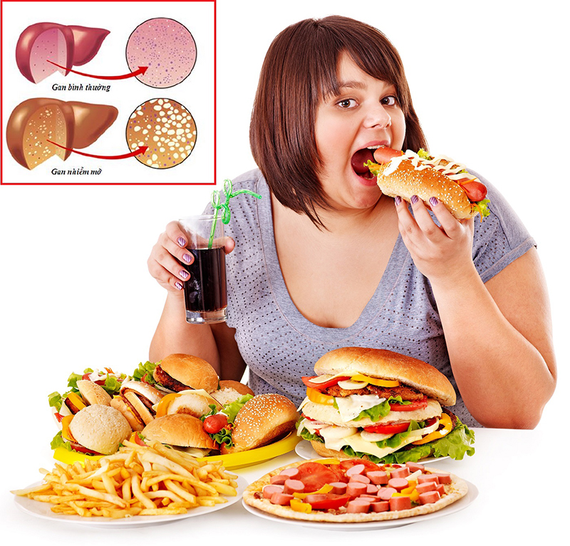 Ăn nhiều thức ăn chứa nhiều dầu mỡ khiến gan bị nhiễm mỡ