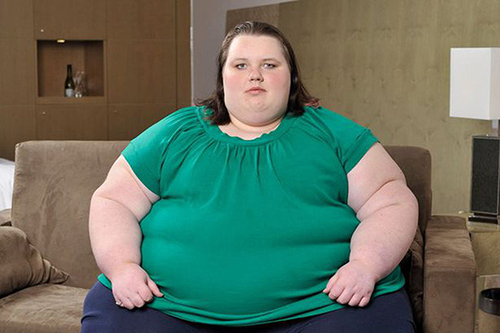 Béo phì và béo dụng là một trong những nguyên nhân gây nên gan nhiễm mỡ