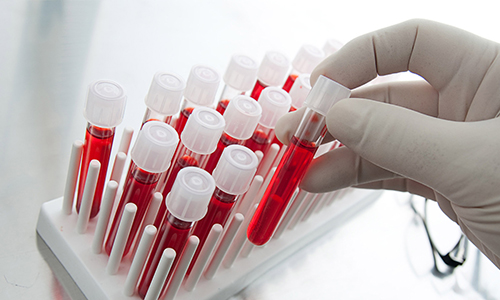 Xét nghiệm máu giúp kiểm tra, đánh giá chức năng gan
