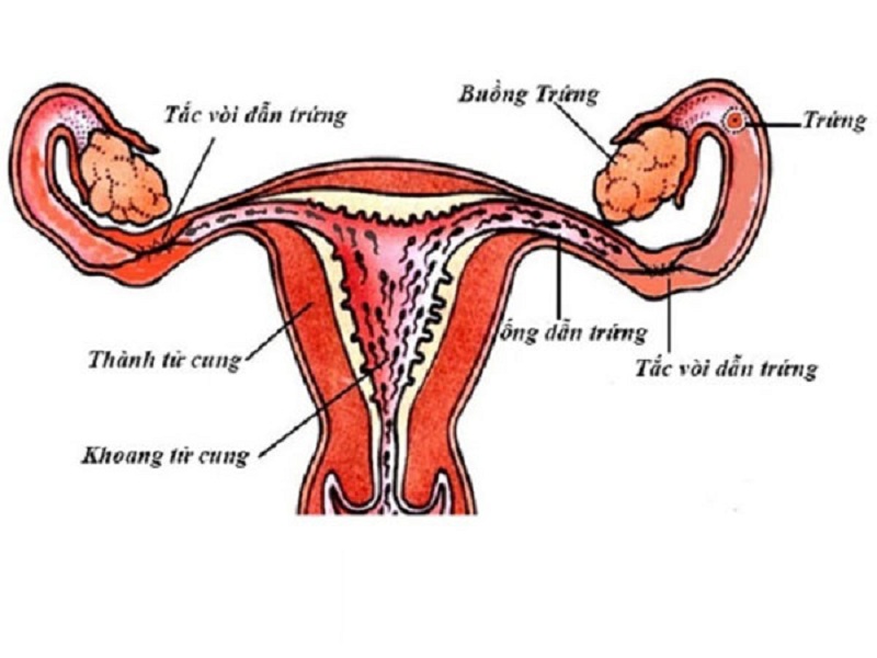 Phụ nữ bị tắc ống dẫn trứng sẽ dẫn đến vô sinh