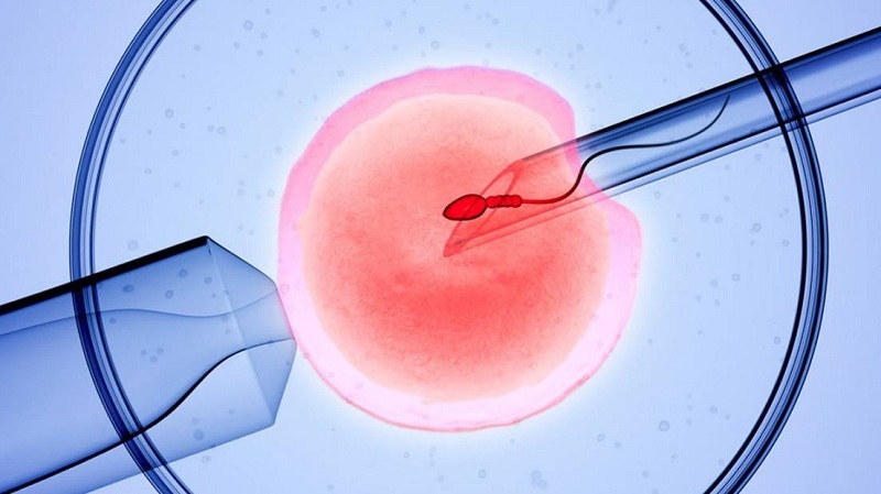 IVF (thụ tinh trong ống nghiệm)