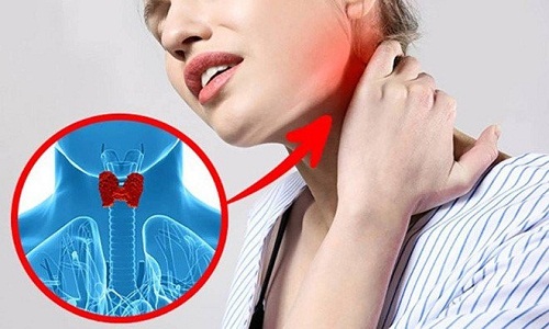 Hormon tuyến giáp tăng có thể gây đau mỏi cổ vai gáy