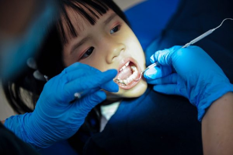 Khám răng bảo hiểm y tế có được chi trả trong những trường hợp cụ thể