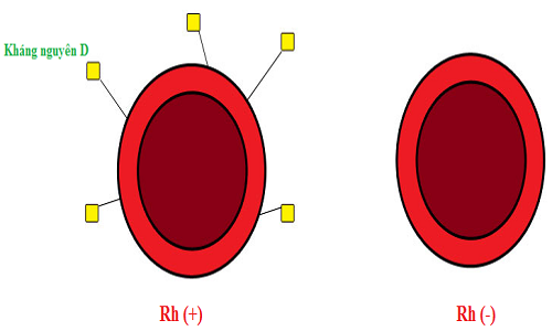 Kháng nguyên D trên bề mặt hồng cầu quy định hệ nhóm máu Rh