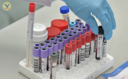 mẫu xét nghiệm HIV tại nhà được chuyển tới bệnh viện thực hiện phân tích