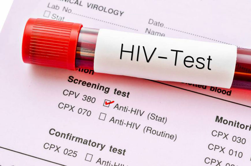 Nên xét nghiệm HIV sau 2 - 3 tháng và thực hiện tối đa 3 lần