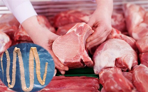 Sán lợn có thể nhiễm vào cơ thể người qua việc ăn thức ăn chưa nấu chín kỹ