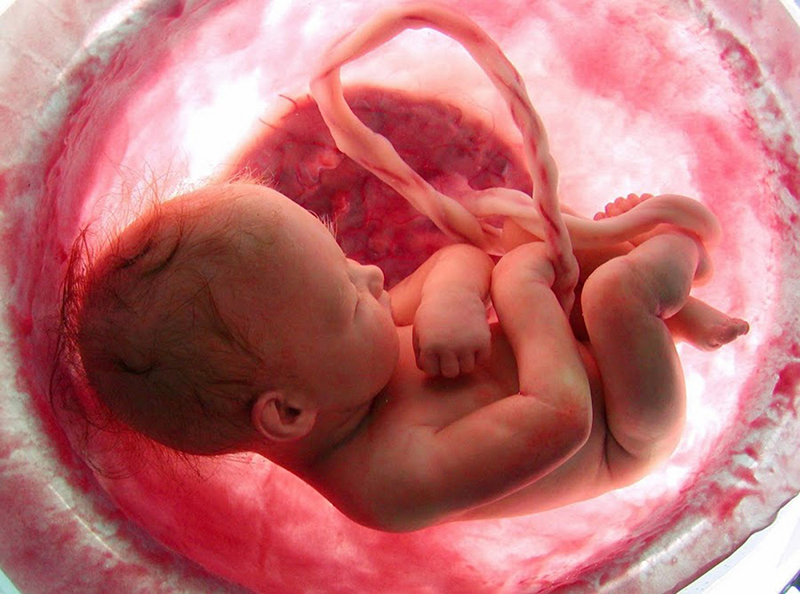 Sàng lọc trước sinh có thể phát hiện ra những bệnh lý bẩm sinh của thai nhi trong bụng mẹ