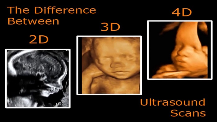 Những hình ảnh thu được từ công nghệ siêu âm 3D rất sắc nét, thấy được cả những chi tiết nhỏ của thai nhi